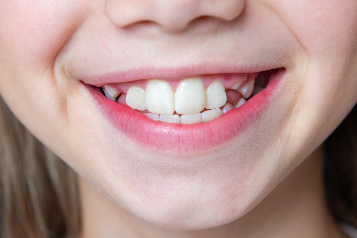 cosmetic dentistry waldorf